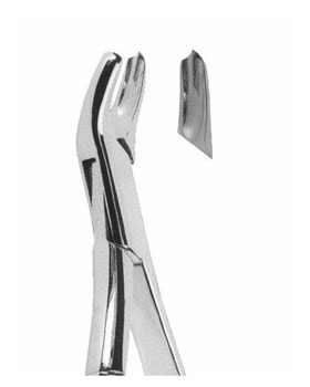<span>Upper Molars Left </span>