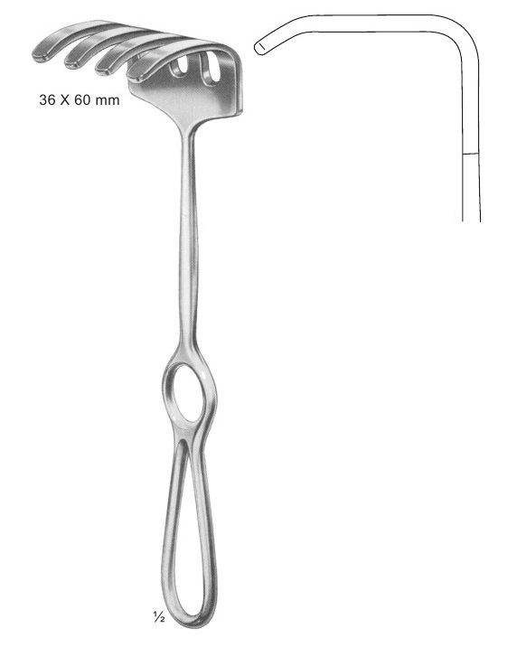 <span>Ollier</span>